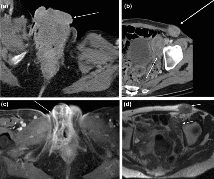 Fig. 5