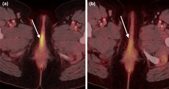 Fig. 6