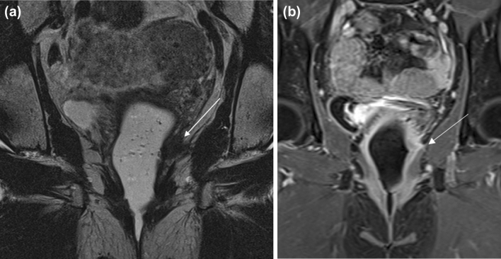 Fig. 10