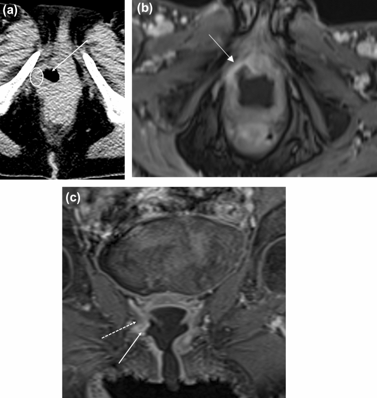 Fig. 11