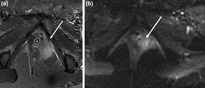 Fig. 14