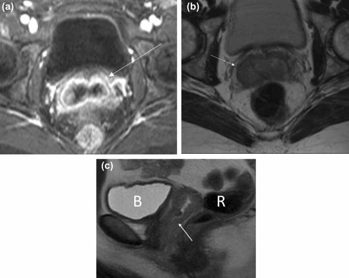 Fig. 9