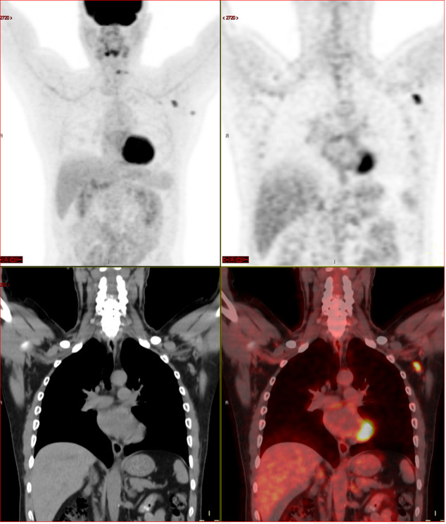 Figure 2: