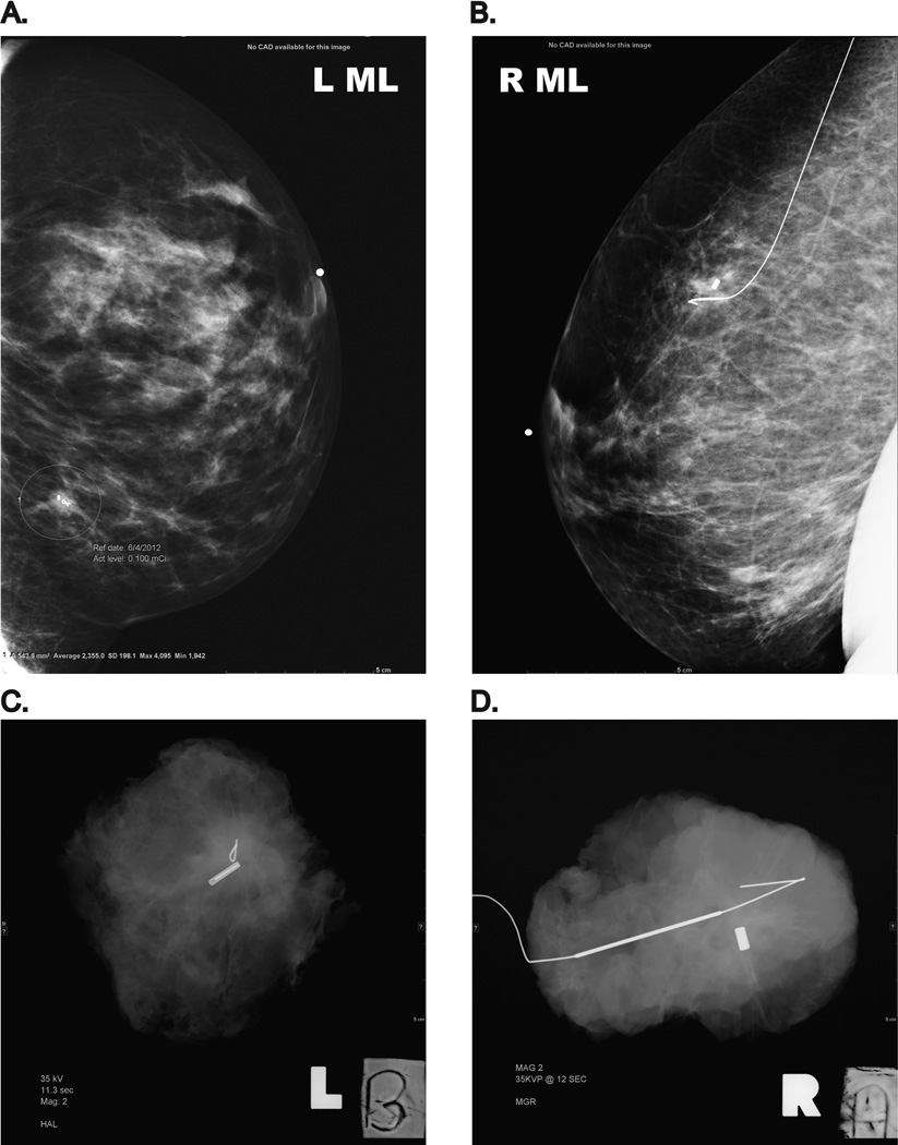 FIG 1