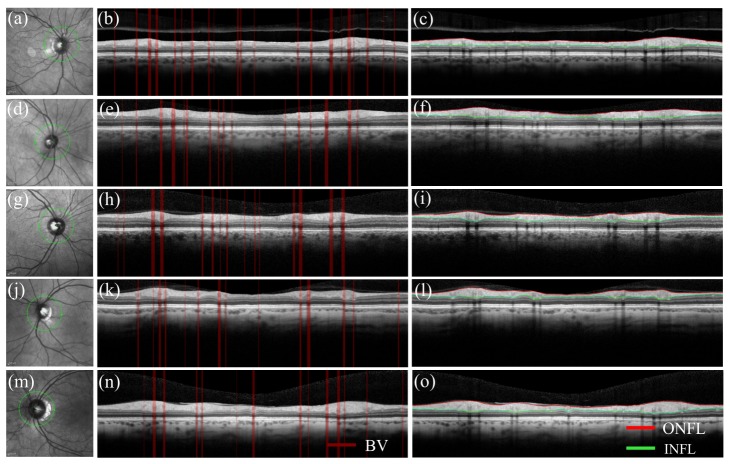 Fig. 2