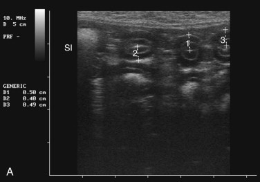 FIGURE 23-27