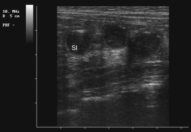 FIGURE 23-31