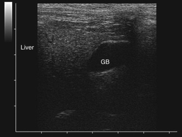 FIGURE 23-61