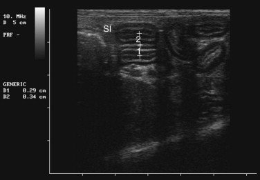 FIGURE 23-20