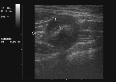 FIGURE 23-24