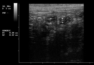 FIGURE 23-19