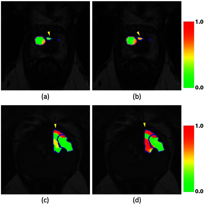 Fig. 7