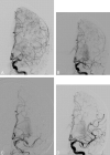 Fig 1.