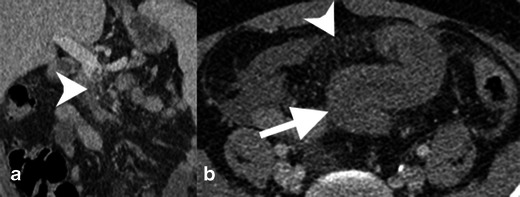 Fig. 13