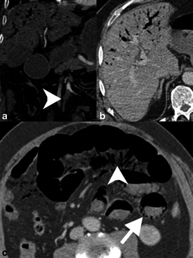 Fig. 14