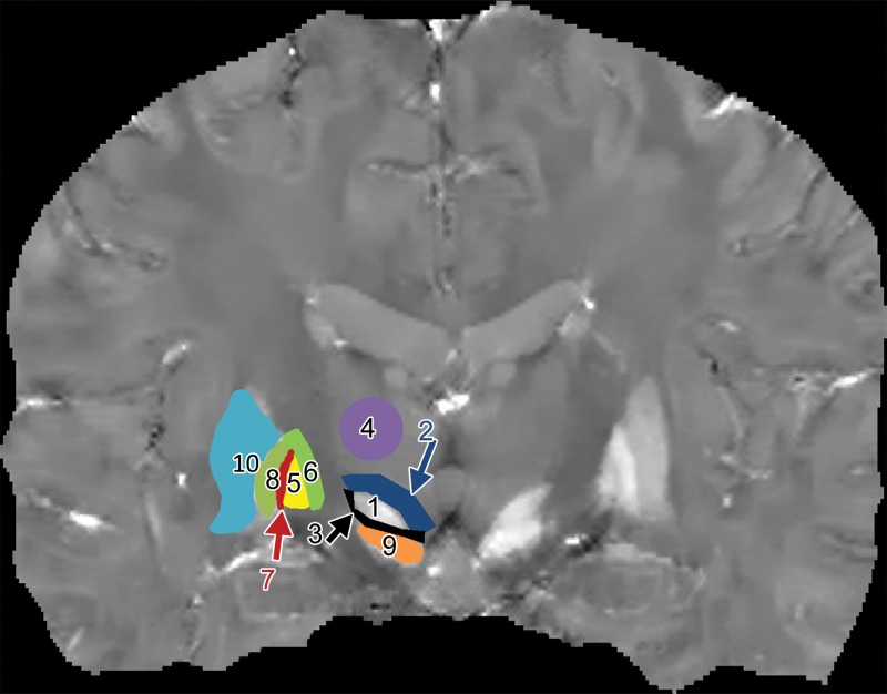 Figure 1a: