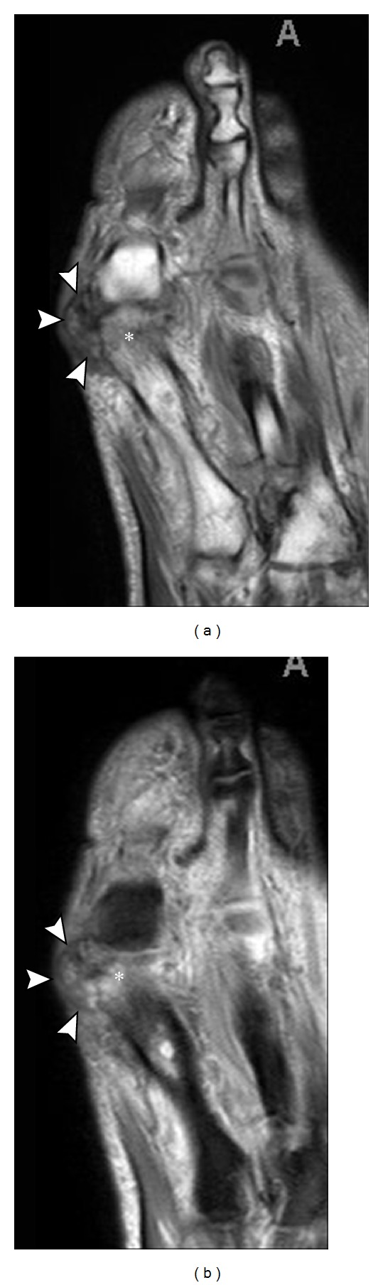 Figure 21