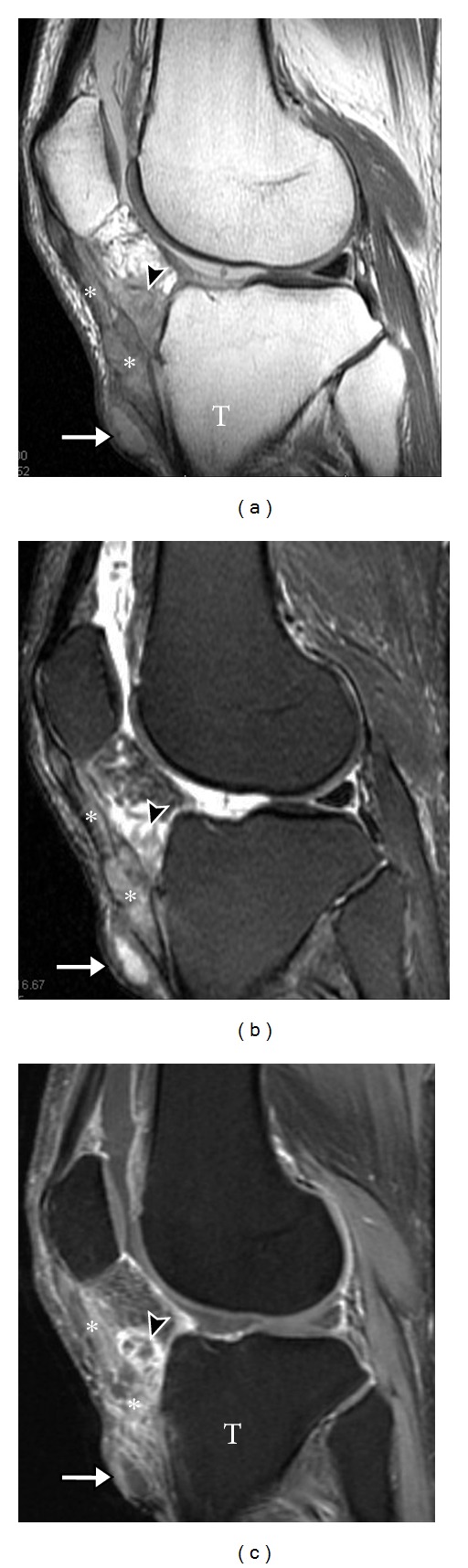 Figure 18