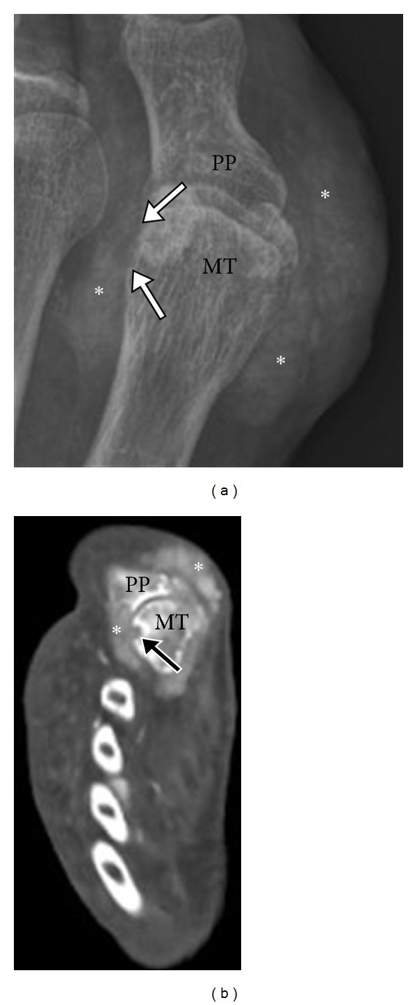 Figure 14