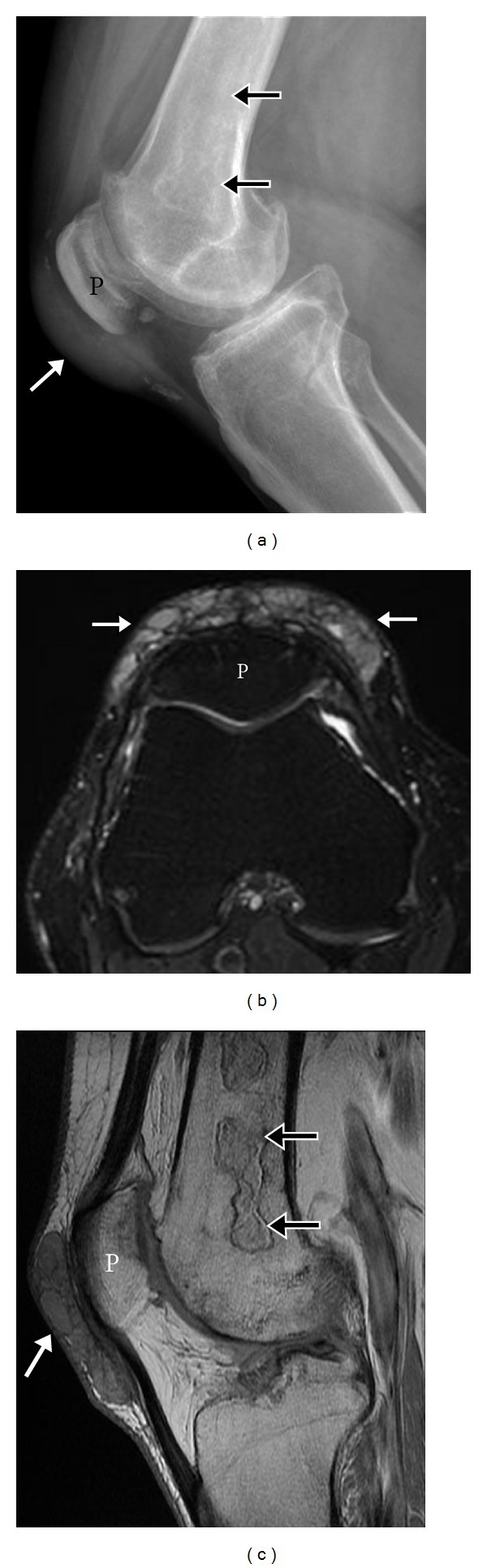 Figure 17