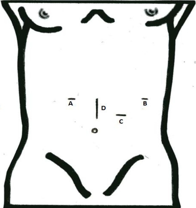 Fig. 1