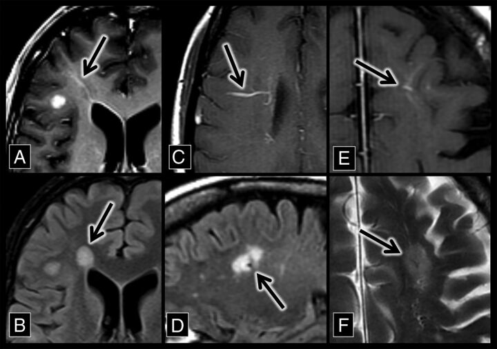 Fig 1.