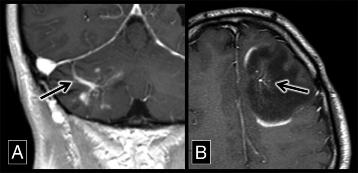 Fig 3.