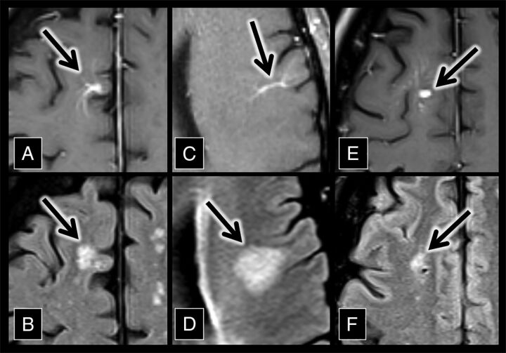 Fig 2.