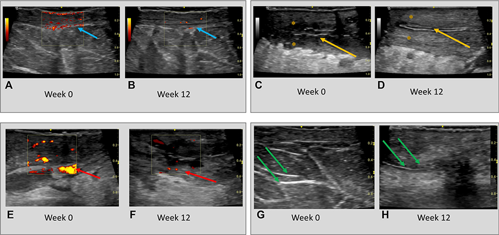 Fig 4.