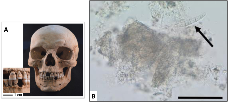 Fig. 1