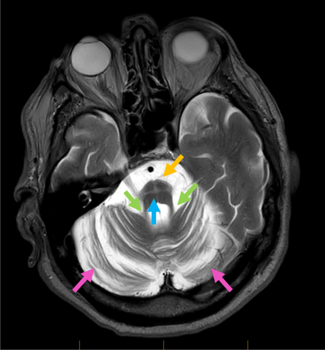 Fig. 3