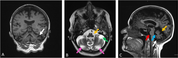 Fig. 2