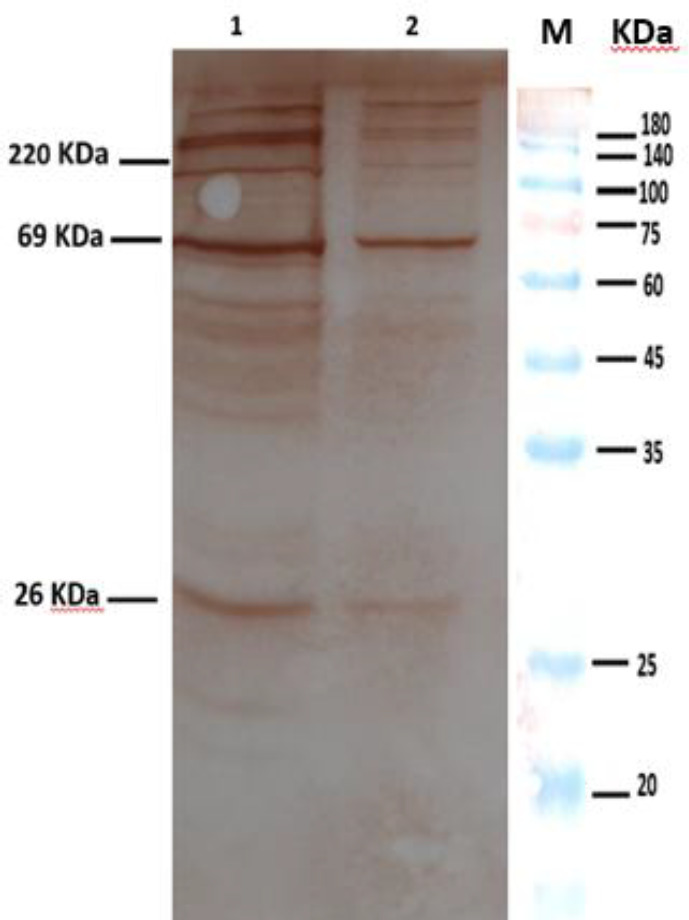 Evaluation Of Outer Membrane Vesicles Obtained From Predominant Local 