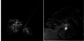 Fig. 11