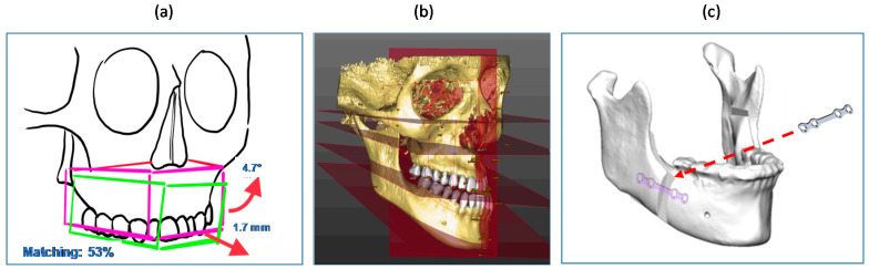 Figure 9