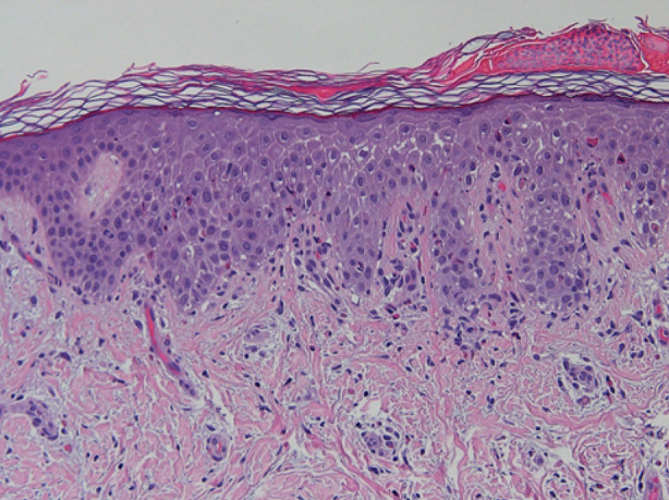 Fig. 2