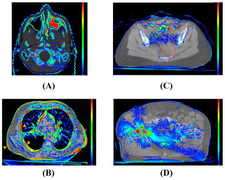 Figure 10