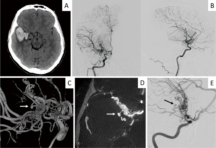 Fig. 1