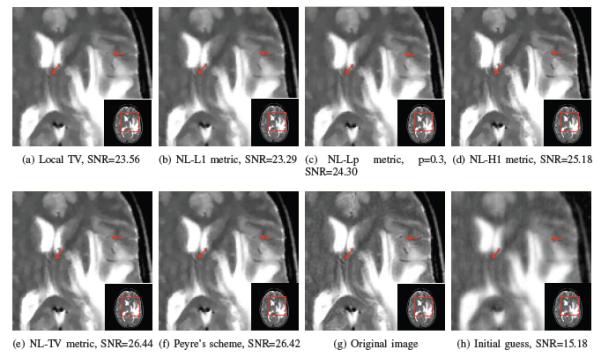 Fig. 9