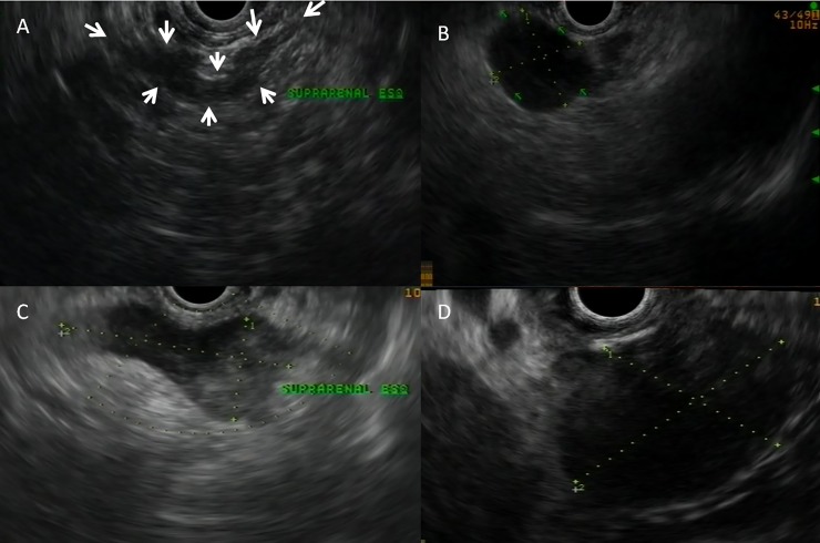 Fig 2