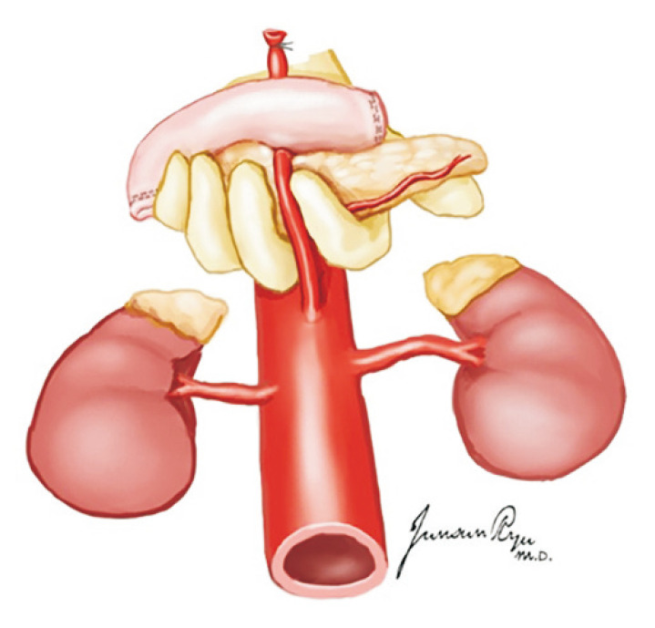 Fig. 17