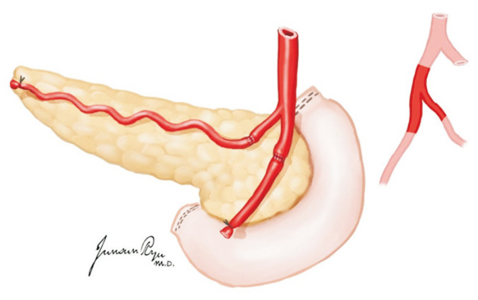 Fig. 19