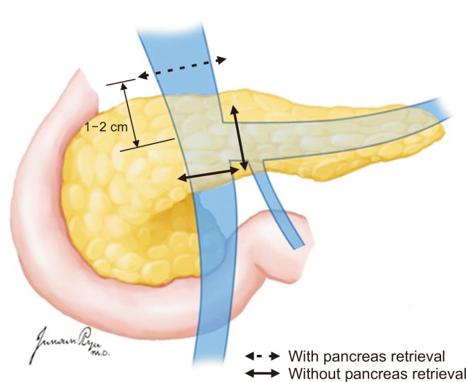 Fig. 12