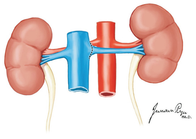 Fig. 21