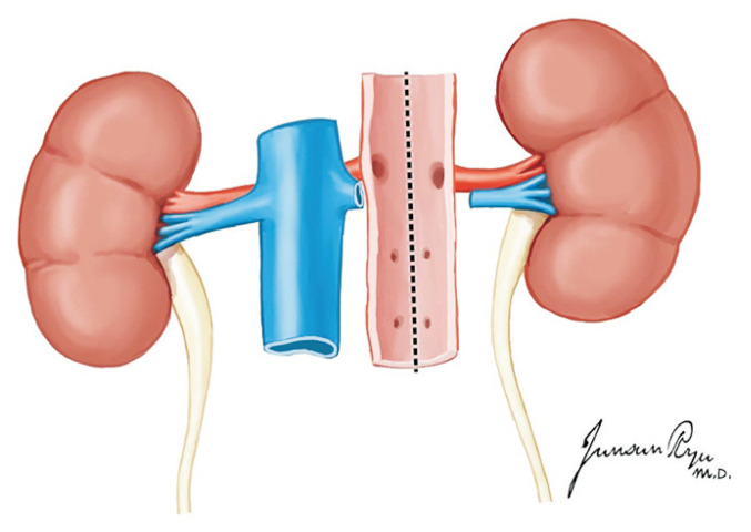 Fig. 22