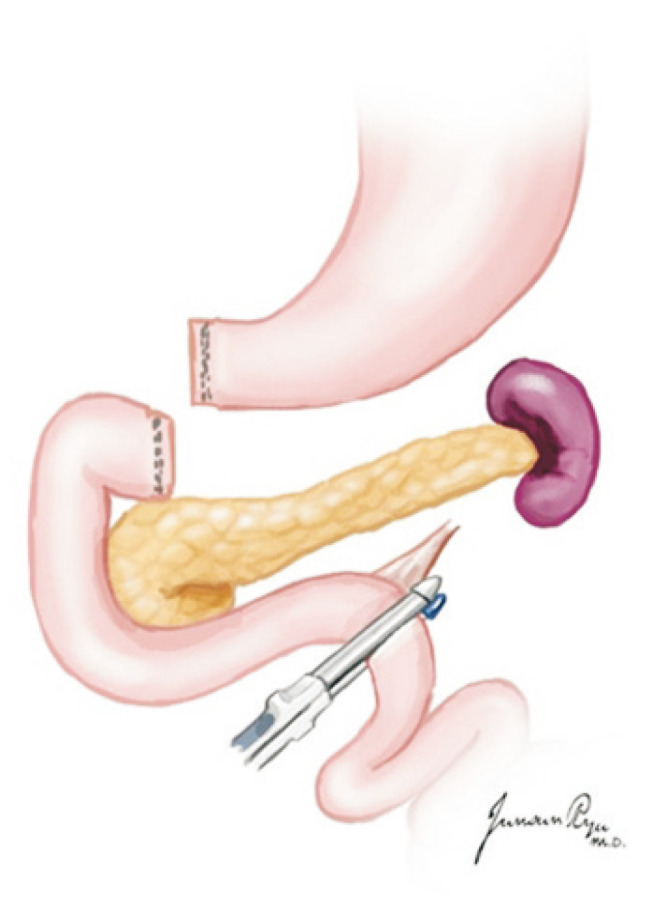 Fig. 16