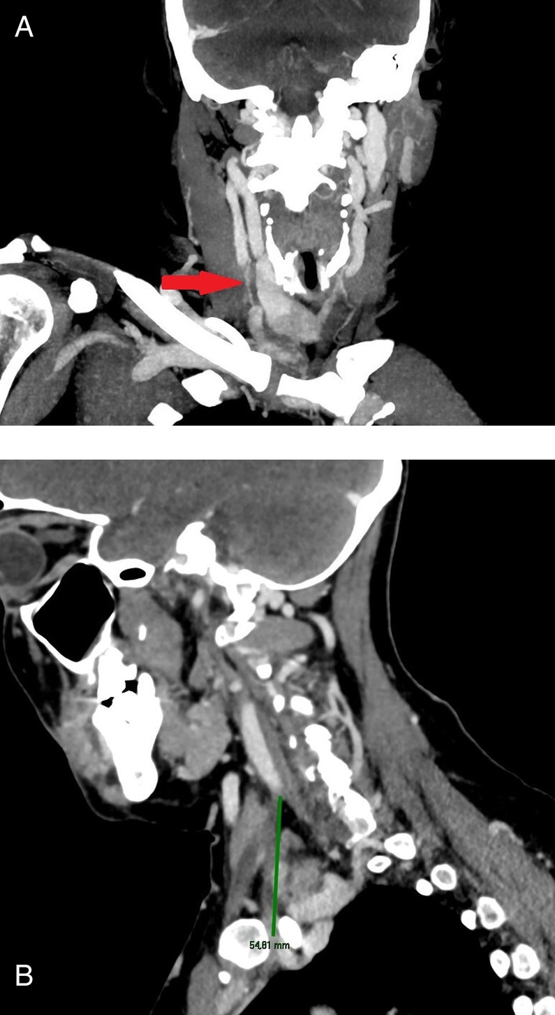 Figure 2