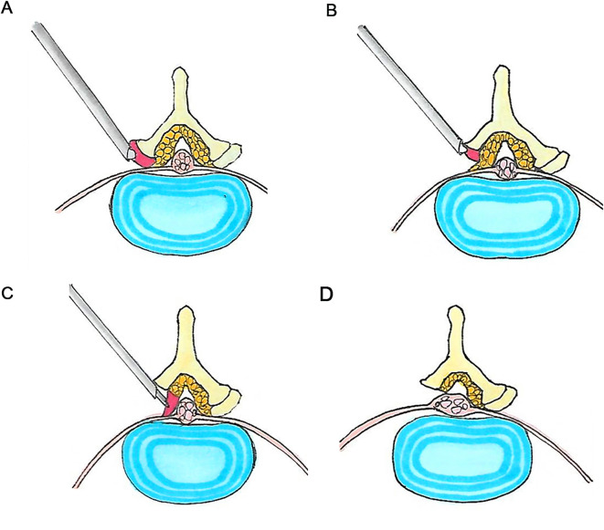 Fig. 4