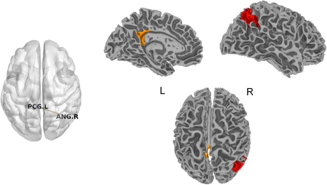 FIGURE 1