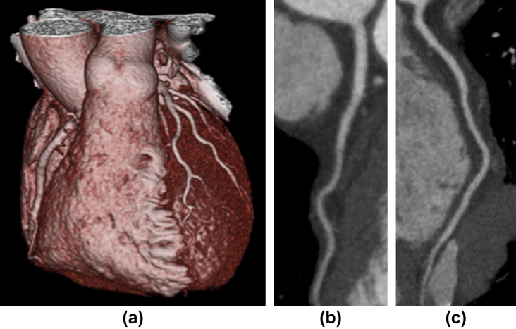 Figure 3